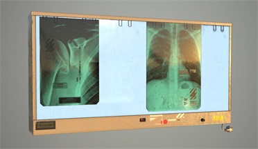 医学 X 射线图像查看器gltf,glb模型下载，3d模型下载